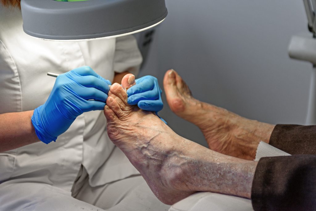geriatrik ayak bakımı